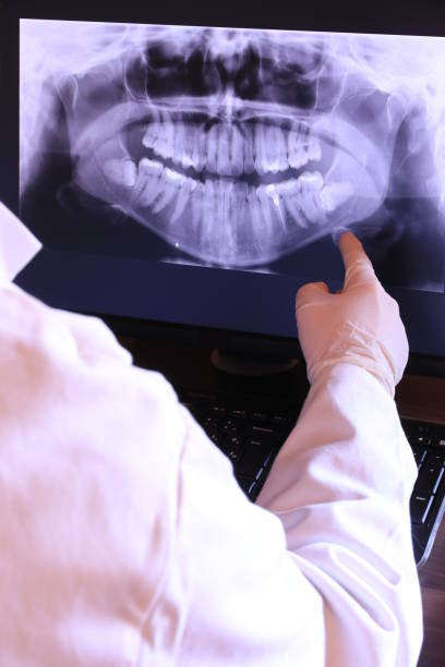 Best Emergency Wisdom Teeth Removal in West Athens, CA